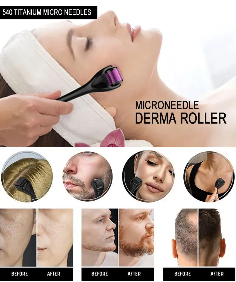 Derma Roller, Needle Roller - Anti-Ageing System with 540 Needles 0.50mm For Skin Hair